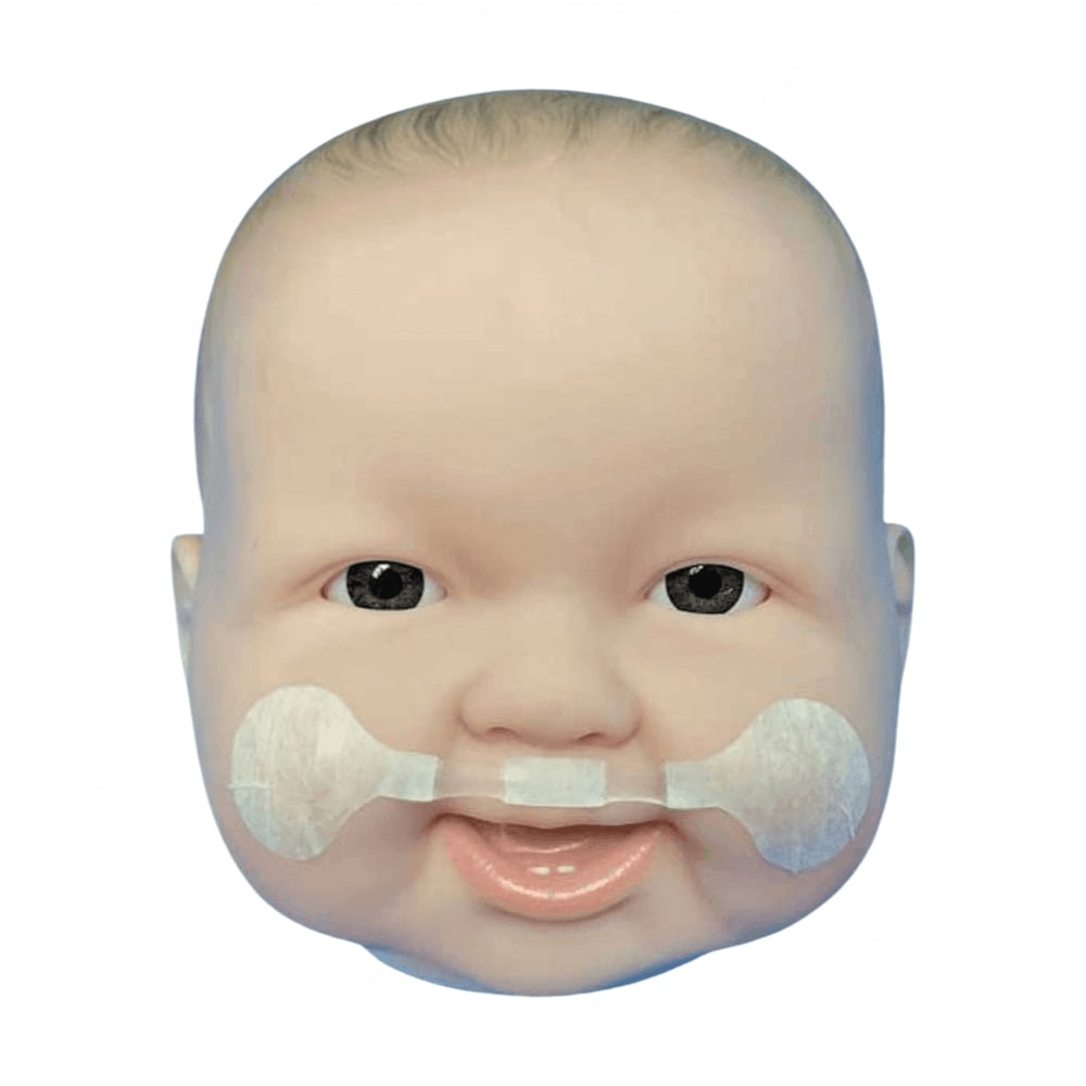 Dyna Cleft Bilateral Positioning Strips